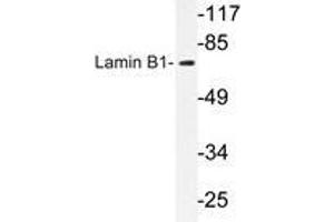 Western blot analysis of Lamin B1 antibody in extracts from COLO cells. (Lamin B1 anticorps)