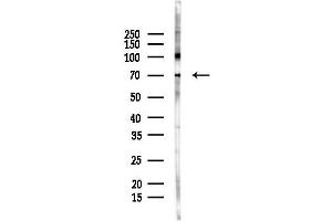 Western blot analysis of lysates from F10-LUC cells(heat-shock 45 min treatment), using EMR3 Antibody at 1/1000 dilution.