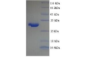 SDS-PAGE (SDS) image for Prion Protein (PRNP) (AA 29-231) protein (His tag) (ABIN5713754)