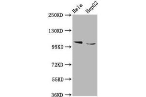 Western Blot Positive WB detected in: Hela whole cell lysate, HepG2 whole cell lysate All lanes: IKBKAP antibody at 5. (IKAP/p150 anticorps  (AA 1107-1258))