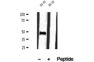 Western blot analysis of extracts of HEK-293 cells, using IFT57 antibody. (IFT57 anticorps  (Internal Region))