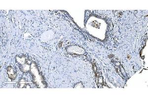 IHC analysis of GCHFR using anti-GCHFR antibody (ABIN7600511).