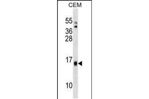 Western blot analysis in CEM cell line lysates (35ug/lane). (SAA4 anticorps  (C-Term))