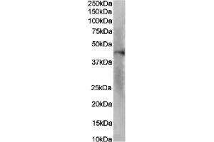 Western Blot using anti-IL-8RA antibody SE2.