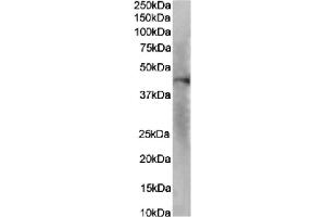 Western Blot using anti-IL-8RA antibody SE2.