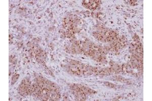 Image no. 1 for anti-PRELI Domain Containing 1 (PRELID1) (AA 1-189) antibody (ABIN1500400)