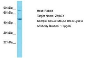 Image no. 1 for anti-Zinc Finger and BTB Domain Containing 7C (ZBTB7C) (AA 181-230) antibody (ABIN6750236) (ZBTB7C anticorps  (AA 181-230))