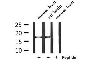 Western blot analysis of extracts from mouse liver ,rat brain, using NDUFA13 Antibody.