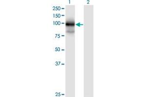 Western Blot analysis of MGC16169 expression in transfected 293T cell line by MGC16169 monoclonal antibody (M01), clone 7A7. (TBCK anticorps  (AA 601-700))