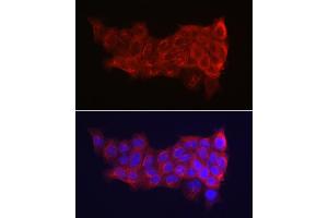 Immunofluorescence analysis of A-431 cells using Cytokeratin 14 (KRT14) Rabbit pAb (ABIN7268092) at dilution of 1:150 (40x lens). (KRT14 anticorps  (C-Term))