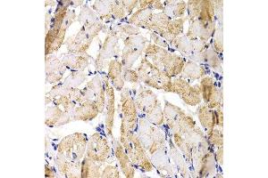 Immunohistochemistry of paraffin-embedded rat heart using MBNL1 antibody.