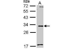 WB Image Sample (30 ug of whole cell lysate) A: A549 12% SDS PAGE antibody diluted at 1:1000 (MMP7 anticorps  (C-Term))