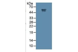 Rabbit Detection antibody from the kit in WB with Positive Control: Sample Human Placenta Tissue. (MMP11 Kit ELISA)