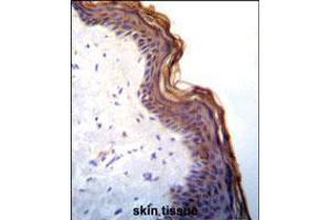 Kallikrein 7(KLK7) Antibody immunohistochemistry analysis in formalin fixed and paraffin embedded human skin tissue followed by peroxidase conjugation of the secondary antibody and DAB staining. (Kallikrein 7 anticorps  (C-Term))
