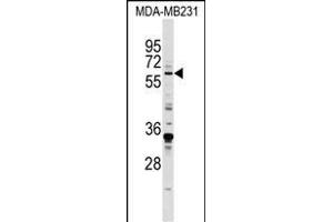 EGR1 Antibody (N-term) (ABIN389442 and ABIN2839514) western blot analysis in MDA-M cell line lysates (35 μg/lane).