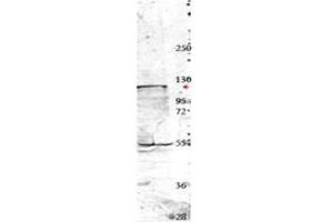 Image no. 1 for anti-Neural Precursor Cell Expressed, Developmentally Down-Regulated 4, E3 Ubiquitin Protein Ligase (NEDD4) (Internal Region) antibody (ABIN293884) (NEDD4 anticorps  (Internal Region))