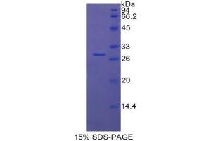 SDS-PAGE of Protein Standard from the Kit (Highly purified E. (LBP Kit ELISA)