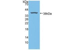 Figure. (Biliverdin Reductase anticorps  (AA 10-279))