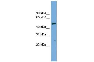 WB Suggested Anti-EXOC4 Antibody Titration: 0. (Sec8 anticorps  (N-Term))