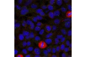 Immunofluorescence staining of methanol-fixed HeLa cells using EIF4G1 polyclonal antibody . (EIF4G1 anticorps  (Ser1232))