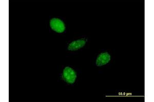 Immunofluorescence of monoclonal antibody to GTF2A1L on HeLa cell.