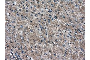 Immunohistochemical staining of paraffin-embedded liver tissue using anti-DPP4mouse monoclonal antibody. (DPP4 anticorps)