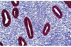 Human Uterus: Formalin-Fixed, Paraffin-Embedded (FFPE) (Keratin Basic anticorps)