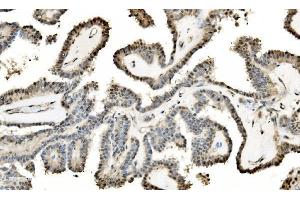 IHC analysis of LSM2 using anti-LSM2 antibody (ABIN7602832).
