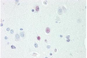 Human Brain, Cortex: Formalin-Fixed, Paraffin-Embedded (FFPE)