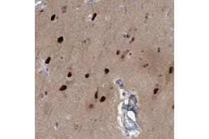 Immunohistochemical staining of human cerebral cortex with SOX7 polyclonal antibody  shows strong nuclear positivity in neuronal cells at 1:50-1:200 dilution. (PINX1 anticorps)