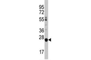 Western blot analysis of LIN28B antibody and HL-60 lysate (LIN28B anticorps  (AA 218-250))