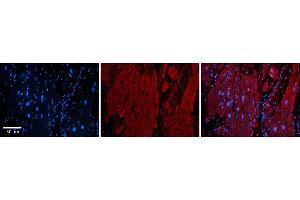 Rabbit Anti-ZFP36L1 Antibody  Catalog Number: ARP33382_P050 Formalin Fixed Paraffin Embedded Tissue: Human Adult heart  Observed Staining: Cytoplasmic Primary Antibody Concentration: 1:600 Secondary Antibody: Donkey anti-Rabbit-Cy2/3 Secondary Antibody Concentration: 1:200 Magnification: 20X Exposure Time: 0. (ZFP36L1 anticorps  (N-Term))