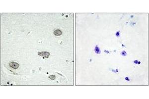 Immunohistochemistry analysis of paraffin-embedded human brain, using CSFR (Phospho-Tyr809) Antibody. (CSF1R anticorps  (pTyr809))