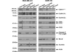 Immunoblot analyses following small interfering RNA-mediated downregulation of CDK11 and CK2 in breast cancer cells.