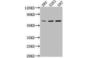 Western Blot Positive WB detected in: 293 whole cell lysate, U251 whole cell lysate, U87 whole cell lysate All lanes: TCF7L1 antibody at 1:1000 Secondary Goat polyclonal to rabbit IgG at 1/50000 dilution Predicted band size: 63 kDa Observed band size: 63 kDa (TCF7L1 anticorps  (AA 80-99))