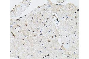 Immunohistochemistry of paraffin-embedded Mouse heart using GTF2H2 Polyclonal Antibody at dilution of 1:100 (40x lens). (GTF2H2 anticorps)