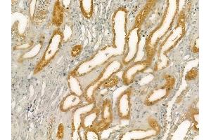 ABIN6262070 and ABIN6276489 at 1/100 staining human normal kidney tissue by IHC-P. (GPX5 anticorps  (Internal Region))