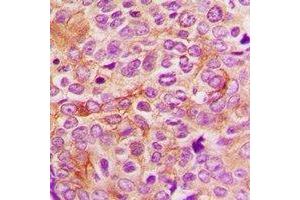 Immunohistochemistry (IHC) image for anti-serine Peptidase Inhibitor, Kunitz Type, 2 (SPINT2) antibody (ABIN7308370)