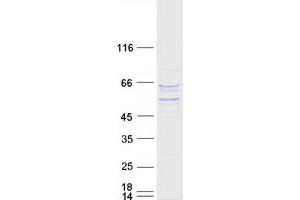 Validation with Western Blot