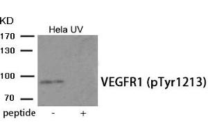 Western blot analysis of extracts from HeLa cells treated with UV using Phospho-VEGFR1 (Tyr1213) antibody. (FLT1 anticorps  (pTyr1213))