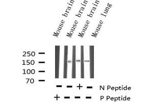Western blot analysis of Phospho-Bcr (Tyr177) expression in various lysates