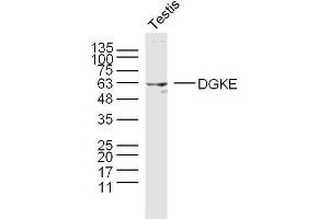 Mouse testis lysates probed with DGKE Polyclonal Antibody, unconjugated  at 1:300 overnight at 4°C followed by a conjugated secondary antibody at 1:10000 for 90 minutes at 37°C. (DGKE anticorps  (AA 1-100))
