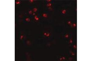 Immunofluorescence staining of human spleen tissue with 20 ug/mL NLRP3 polyclonal antibody . (NLRP3 anticorps  (AA 120-170))