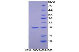SDS-PAGE (SDS) image for Retinol Binding Protein 2, Cellular (RBP2) (AA 1-134) protein (His tag) (ABIN1080636)