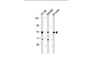 All lanes : Anti-Villin-1 Antibody (N-term) at 1:8000 dilution Lane 1: HT-29 whole cell lysate Lane 2: S whole cell lysate Lane 3: Mouse colon lysate Lysates/proteins at 20 μg per lane.