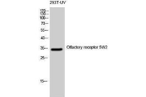 Western Blotting (WB) image for anti-Olfactory Receptor, Family 5, Subfamily W, Member 2 (OR5W2) (Internal Region) antibody (ABIN3186172) (OR5W2 anticorps  (Internal Region))