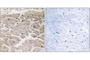Immunohistochemistry (IHC) image for anti-ATP/GTP Binding Protein-Like 2 (AGBL2) (AA 731-780) antibody (ABIN2890249) (AGBL2 anticorps  (AA 731-780))