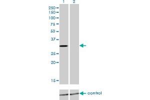 Western blot analysis of KCNIP2 over-expressed 293 cell line, cotransfected with KCNIP2 Validated Chimera RNAi (Lane 2) or non-transfected control (Lane 1). (KCNIP2 anticorps  (AA 1-100))