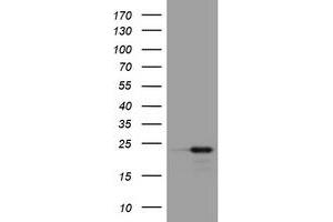 Image no. 1 for anti-Visinin-Like 1 (VSNL1) (AA 2-191) antibody (ABIN1491148) (VSNL1 anticorps  (AA 2-191))