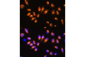 Immunohistochemistry of paraffin-embedded human tonsil using  Rabbit pAb (ABIN3021619, ABIN3021620, ABIN3021621 and ABIN6215402) at dilution of 1:100 (40x lens).